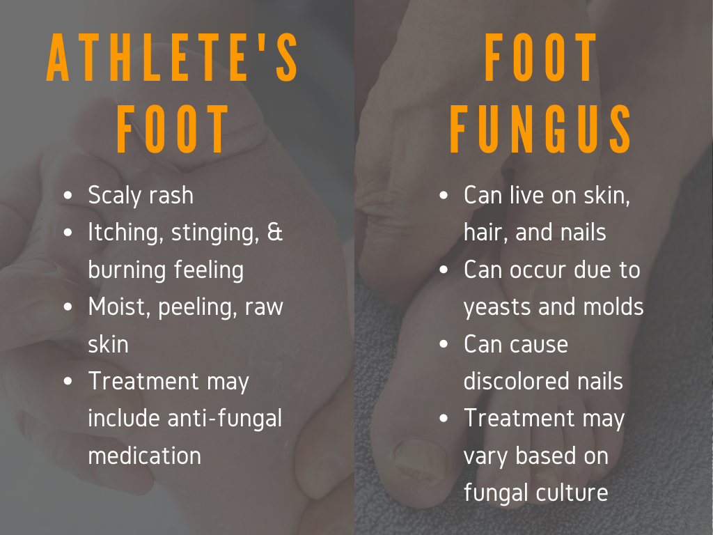 athelete's foot vs foot fungus infographic